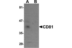 Western Blotting (WB) image for anti-CD81 (CD81) (N-Term) antibody (ABIN1031309) (CD81 antibody  (N-Term))