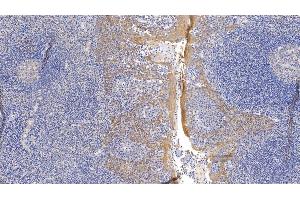 Detection of CK17 in Human Tonsil Tissue using Monoclonal Antibody to Cytokeratin 17 (CK17) (KRT17 antibody  (AA 252-393))