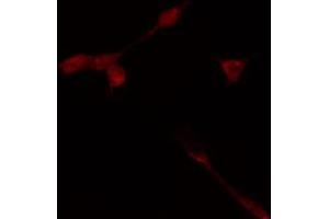 ABIN6274368 staining HeLa cells by IF/ICC. (TAF1A antibody  (Internal Region))
