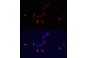 Immunofluorescence analysis of PC-12 cells using WDR81 antibody (ABIN6294099) at dilution of 1:100.