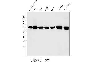 Western blot analysis of mGluR1/GRM1 using anti-mGluR1/GRM1 antibody (ABIN7600912). (Metabotropic Glutamate Receptor 1 antibody  (AA 25-466))