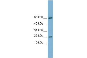 WB Suggested Anti-LGALS14 Antibody Titration:  0. (LGALS14 antibody  (N-Term))