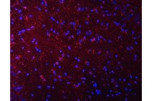 IF analysis of Septin 2/SEPTIN2 using anti-Septin 2/SEPTIN2 antibody (ABIN7599275).