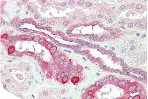 ABIN185517 (5µg/ml) staining of paraffin embedded Human Kidney. (HVEM antibody  (Internal Region))
