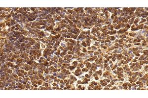 Immunohistochemistry (IHC) image for anti-Interleukin 17 (IL17) (AA 21-153) antibody (ABIN7427654)