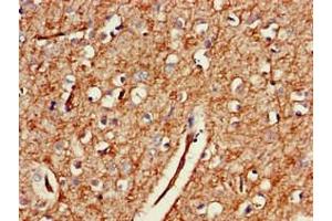 Immunohistochemistry (IHC) image for anti-GRB2-Associated Binding Protein 2 (GAB2) (AA 273-484) antibody (ABIN7154436)