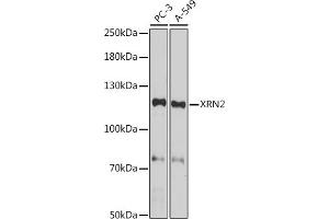 Western blot analysis of extracts of various cell lines, using XRN2 antibody (ABIN7265345) at 1:1000 dilution.
