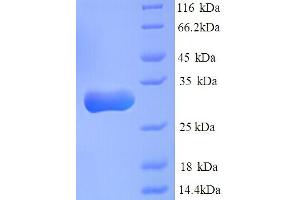 Carbonyl Reductase 1 (CBR1) (AA 45-320), (partial) protein (His tag)