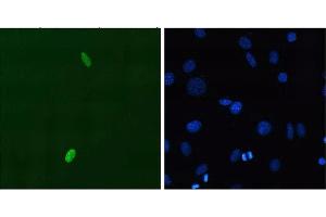 Immunofluorescent staining using P2B1 mouse monoclonal anti-DUX4 N-terminus on C2C12 myoblasts transfected with pCS2+DUX4. (DUX4 antibody)