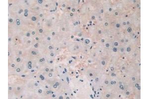 Detection of TLR3 in Human Liver Tissue using Polyclonal Antibody to Toll Like Receptor 3 (TLR3) (TLR3 antibody  (AA 404-532))