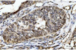 IHC analysis of HES5 using anti-HES5 antibody (ABIN7598966). (HES5 antibody  (AA 1-121))