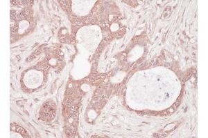 Immunohistochemistry (IHC) image for anti-Sequestosome 1 (SQSTM1) (AA 325-375) antibody (ABIN7454876) (SQSTM1 antibody  (AA 325-375))