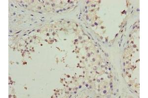Immunohistochemistry of paraffin-embedded human testis tissue using ABIN7165927 at dilution of 1:100 (CPI-17 antibody  (Regulatory Subunit 14A))