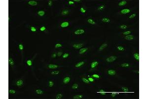Immunofluorescence of monoclonal antibody to MAGEA2 on HeLa cell. (MAGEA2 antibody  (AA 1-314))