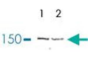 Western Blot (Cell lysate) analysis of (1) nuclear extracts of HeLa cells, and (2) purified human SKI complex. (TTC37 antibody)