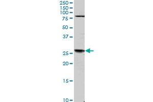 TGIF2 monoclonal antibody (M01), clone 4C10. (TGIF2 antibody  (AA 131-236))