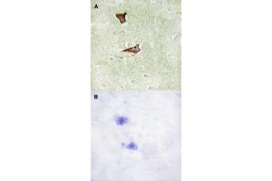 Immunohistochemical staining (Formalin-fixed paraffin-embedded sections) of human brain tissue with IGF2R (phospho S2409) polyclonal antibody  without blocking peptide (A) or preincubated with blocking peptide (B) under 1:50-1:100 dilution. (IGF2R antibody  (pSer2409))