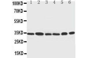 Anti-Cdk4 antibody,  Western blotting Lane 1: Rat Thymus Tissue Lysate Lane 2: HELA Cell Lysate Lane 3: MCF-7 Cell Lysate Lane 4: A549 Cell Lysate Lane 5: COLO320 Cell Lysate Lane 6: JURKAT Cell Lysate (CDK4 antibody  (C-Term))
