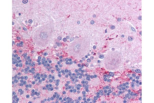 KCNIP4 antibody  (AA 27-76)