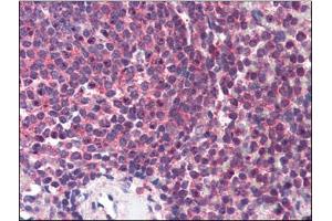 Human Spleen (formalin-fixed, paraffin-embedded) stained with HNF4Aat 2 µg/ml followed by biotinylated anti-goat IgG secondary antibody, alkaline phosphatase-streptavidin and chromogen. (HNF4A antibody  (N-Term))
