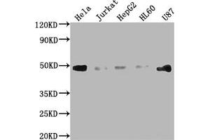Western Blot Positive WB detected in: Hela whole cell lysate, Jurkat whole cell lysate, HepG2 whole cell lysate, HL60 whole cell lysate, U87 whole cell lysate All lanes: FAS antibody at 1:2000 Secondary Goat polyclonal to rabbit IgG at 1/50000 dilution Predicted band size: 38, 12, 10, 17, 15, 36, 25 kDa Observed band size: 45 kDa (Recombinant FAS antibody)