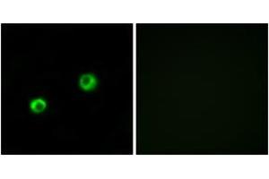 Immunofluorescence analysis of MCF7 cells, using ARSI Antibody. (Arylsulfatase I antibody  (AA 311-360))