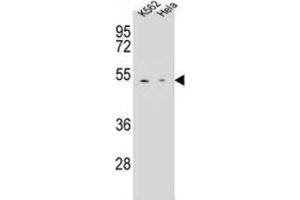 Western Blotting (WB) image for anti-Carboxypeptidase B1 (Tissue) (CPB1) antibody (ABIN2996494)