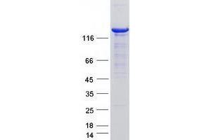 Validation with Western Blot (USP8 Protein (Transcript Variant 1) (Myc-DYKDDDDK Tag))