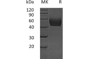 Western Blotting (WB) image for Lumican (LUM) protein (His tag) (ABIN7320810) (LUM Protein (His tag))