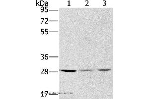 Western blot analysis of A375, hela and A172 cell, using HSD17B12 Polyclonal Antibody at dilution of 1:570 (HSD17B12 antibody)