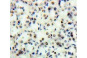 Used in DAB staining on fromalin fixed paraffin-embedded Kidney tissue (TOP2 antibody  (AA 749-987))