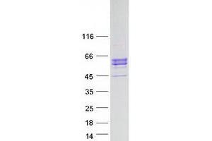 Western Blotting (WB) image for Inositol-Trisphosphate 3-Kinase A (ITPKA) protein (Myc-DYKDDDDK Tag) (ABIN2723916)