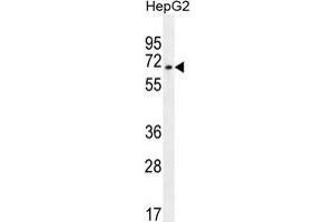 ZNF860 Antibody (C-term) western blot analysis in HepG2 cell line lysates (35 µg/lane). (ZNF860 antibody  (C-Term))