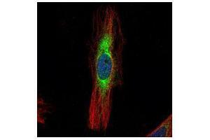 ICC/IF Image Confocal immunofluorescence analysis (Olympus FV10i) of methanol-fixed HeLa, using SCIN, antibody (Green) at 1:500 dilution. (Scinderin antibody)