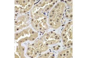 Immunohistochemistry of paraffin-embedded human kidney using ACTL6B antibody. (Actin-Like 6B antibody  (AA 1-280))