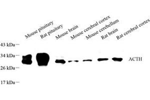 Western blot analysis of ACTH (ABIN7072981) at dilution of 1: 250 (ACTH antibody)