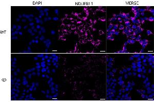 Immunocytochemical staining of HeLa cells using NDUFB11 antibody (ABIN7799549), 1:1,000), Top panel: wild-type (WT), Bottom panal: NDUFB11 shRNA knockdown (KD). (NDUFB11 antibody)