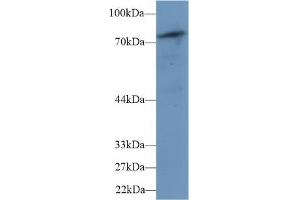 Western blot analysis of Mouse Skeletal muscle lysate, using Human PLCd4 Antibody (1 µg/ml) and HRP-conjugated Goat Anti-Rabbit antibody ( (PLCD4 antibody  (AA 1-250))
