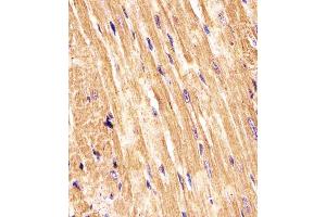 (ABIN6242629 and ABIN6577967) staining (Mouse) Smad1 in Mouse heart tissue sections by Immunohistochemistry (IHC-P - paraformaldehyde-fixed, paraffin-embedded sections). (SMAD1 antibody  (AA 154-187))