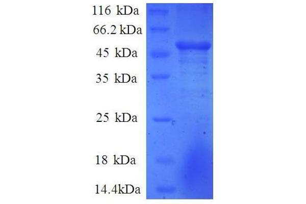 COMMD4 Protein (AA 1-195, partial) (GST tag)