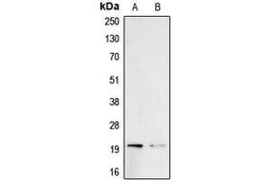 Western blot analysis of Probetacellulin expression in A431 (A), PC3 (B) whole cell lysates.