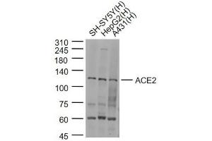 Lane 1: SH-SY5Y cell lysates; Lane 2: HepG2 cell lysates; Lane 3: A431 cell lysates probed with ACE2 Polyclonal Antibody, Unconjugated (bs-23443R) at 1:1000 dilution and 4˚C overnight incubation. (ACE2 antibody  (AA 451-550))