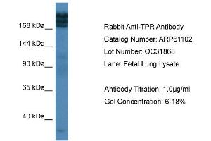 Western Blotting (WB) image for anti-Nucleoprotein TPR (TPR) (C-Term) antibody (ABIN2788674) (TPR antibody  (C-Term))
