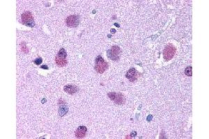 Immunohistochemical (Formalin/PFA-fixed paraffin-embedded sections) staining in human brain with BRS3 polyclonal antibody . (BRS3 antibody)