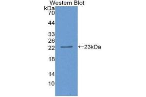 Western Blotting (WB) image for anti-SIVA1, Apoptosis-Inducing Factor (SIVA1) (AA 1-175) antibody (ABIN1867122) (SIVA1 antibody  (AA 1-175))
