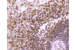 Paraformaldehyde-fixed, paraffin embedded Human spleen tissue, Antigen retrieval by boiling in sodium citrate buffer (pH6. (STAT5B antibody)