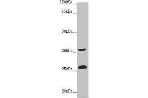 Western blot All lanes: RAB12 antibody at 2 μg/mL + Hela whole cell lysate Secondary Goat polyclonal to rabbit IgG at 1/10000 dilution Predicted band size: 28 kDa Observed band size: 28, 36 kDa (RAB12 antibody  (AA 98-241))