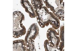 Immunohistochemical staining of human small intestine with FAM134C polyclonal antibody  shows cytoplasmic positivity in glandular cells at 1:50-1:200 dilution. (FAM134C antibody)