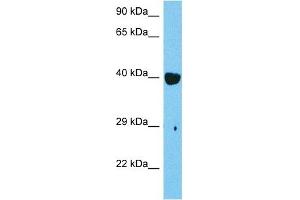 Host:  Mouse  Target Name:  RARB  Sample Tissue:  Mouse Skeletal Muscle  Antibody Dilution:  1ug/ml (Retinoic Acid Receptor beta antibody  (C-Term))