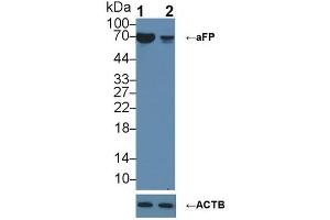 Knockout Varification: ;Lane 1: Wild-type HepG2 cell lysate; ;Lane 2: aFP knockout HepG2 cell lysate; ;Predicted MW: 69kDa ;Observed MW: 69kDa;Primary Ab: 2µg/ml Rabbit Anti-Human aFP Antibody;Second Ab: 0. (alpha Fetoprotein antibody  (AA 31-576))